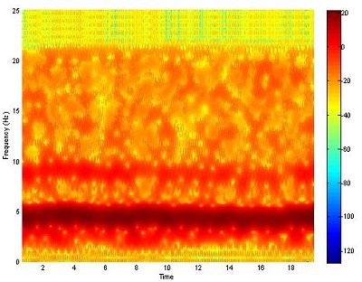 A kézremegés spektrogrammon látható, hogy a 20 mp-es mérés során az 5Hz-es tartománynál látható folyamatos csúcs